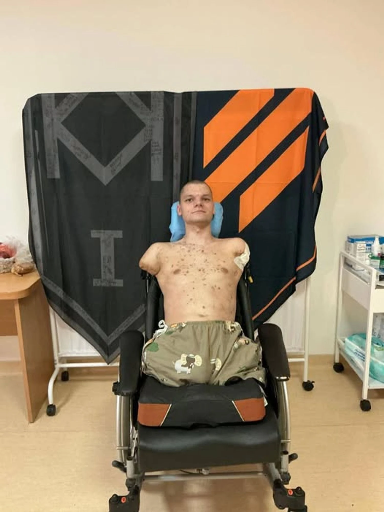 У відділенні ПриватБанку ветерану з ампутацією відмовили у відновленні картки: в НБУ відреагували